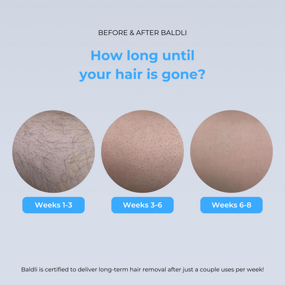 VapoShine Baldli™ Scalp IPL Laser Hair Remover